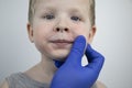 Allergy in the form of redness of the face and rashes, prische in a child. A boy examined by a pediatrician in a hospital.