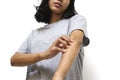 Allergy. Itchy skin. Women`s hands are scratched, on white background