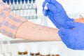 Allergy tests in laboratory Royalty Free Stock Photo