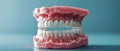 Allo-supported dental prosthesis. Concept Dental Prosthesis, Allo - Supported, Replacement Teeth,