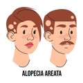 Alopecia areata disease vector isolated