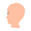 Alopecia hair. Baldness of hair on the head. Anagen Alopecia. Infographics. Vector illustration on isolated background.