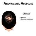 Alopecia hair. Baldness of hair on the head. Androgenic alopecia causes. Infographics. Vector illustration on isolated