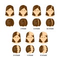 Alopecia stages set. Female balding in process.