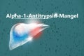 Alpha-1-Antitrypsin-MangelLaurell-Eriksson-Syndrom, Medizinische Checkliste. Texturierter Hintergrund mit leerer Kopierraum