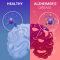 Alzheimer brain banner set, cartoon style