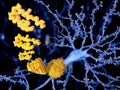 Alzheimer disease, the beta-amyloid peptid Royalty Free Stock Photo