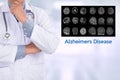 Alzheimers Disease concept , Brain degenerative diseases Parkin