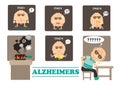 Alzheimers