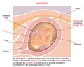 Amnion medical illustration Royalty Free Stock Photo