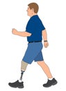 Amputee Walking