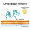 Amyloid-plaque formation. Alzheimer`s disease Royalty Free Stock Photo