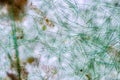 Anabaena is a genus of filamentous cyanobacteria. Royalty Free Stock Photo