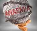 Anaemia and hardship in life - pictured by word Anaemia as a heavy weight on shoulders to symbolize Anaemia as a burden, 3d