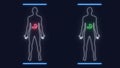 Analysis of Human Anatomy Scan Bddy Stomach desease