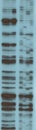 Analysis of RNA sequence