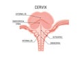 An anatomical diagram of the cervix, featuring labeled sections: Royalty Free Stock Photo