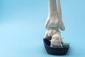 Anatomical model of the bones of the foot wearing an orthopedic insole with copy space concept for Foot health care solutions, Royalty Free Stock Photo