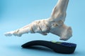 Anatomical model of the bones of the human foot wearing an orthopedic insole concept for Metatarsal health and treatment, Posture