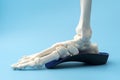 Anatomical model of the bones of the human foot wearing an orthopedic insole concept for Physical therapy for leg injury, Skeletal