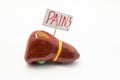 Anatomical model of liver with placard with inscription pain is on white background. Concept photo of pain symptoms and syndromes
