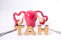 Anatomical shape of uterus with ovaries is at slightly blurred background and in foreground are the letters which form medical acr