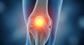 3D Rendering of Human Knee Joint with Glowing Pain Spot Royalty Free Stock Photo