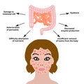 The anatomical structure of the intestine. Bowel diseases affect the skin. Skin inflammation and acne. Vector