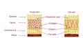 The anatomical structure of the skin. Elastin, hyaluronic acid, collagen. Skin aging, wrinkles before and after Royalty Free Stock Photo