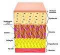 Anatomical structure of the skin. Elastin, Hyaluronic acid, Collagen. Infographics. causes of wrinkles on the skin