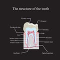 The anatomical structure of the tooth on a black Royalty Free Stock Photo