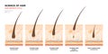 Anatomical training poster. Hair growth phase step by step. Stages of the hair growth cycle. Anagen, telogen, catagen