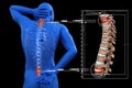 Anatomical vision back pain. Spine anatomy. 3D illustration
