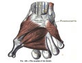 Anatomy drawing and text of the muscles of the thumb, from the 19th-century