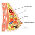 Anatomy of the female breast