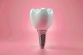 Anatomy of healthy teeth and tooth dental implant. ai generative Royalty Free Stock Photo