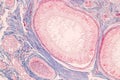 Histological Epididymis and Testis human cells under microscope.