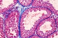 Histological Epididymis and Testis human cells under microscope.