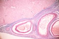 Histological Ovary, Testis and Sperm human cells under microscope.