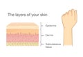 Anatomy of Human Skin layer and arm.