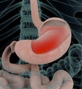 Anatomy illustration of gastric acid or heartburn, inflamed red stomach showing acid in red.