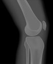 Anatomy of the knee_X Ray knee side