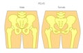 Anatomy_Male and female pelvis Royalty Free Stock Photo