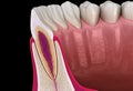 Anatomy of maxillary lateral incisor tooth and gum cross section. Medically accurate dental 3D illustration