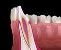 Anatomy of maxillary lateral incisor tooth and gum cross section. Medically accurate dental 3D illustration Royalty Free Stock Photo