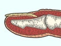 Anatomy, section finger. Sketch scratch board imitation color.