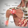 Anatomy of shoulder joint inflammation isolated on transparent background Royalty Free Stock Photo