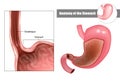 Anatomy of the stomach. Digestive system anatomy