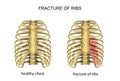 Anatomy of the thorax