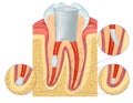 Anatomy of the tooth Royalty Free Stock Photo